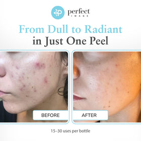 Perfect Image in-use clinic application demonstrating professional treatment and precise results