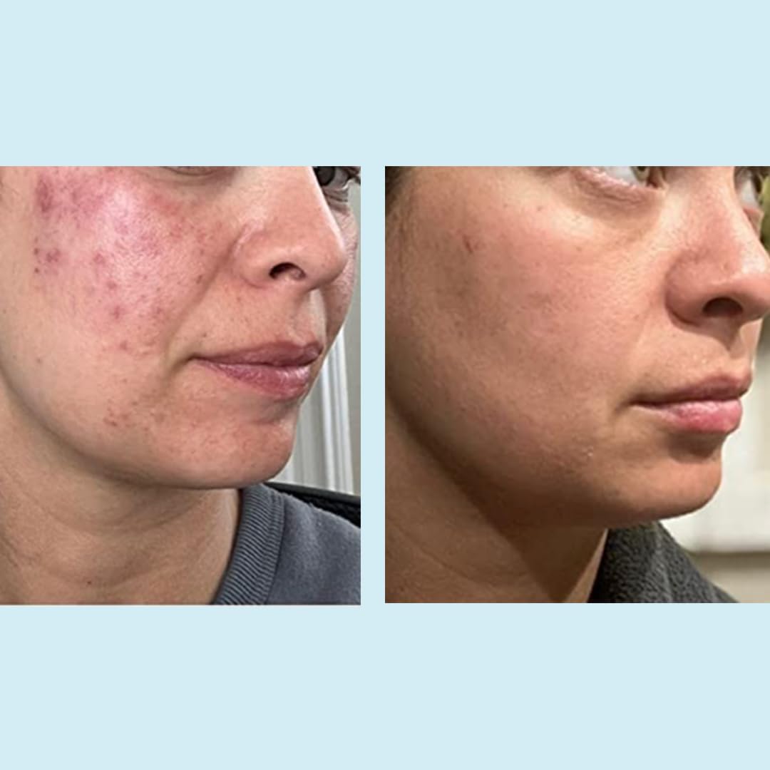 Perfect Image retinol and green tea extract emphasis for soothing support