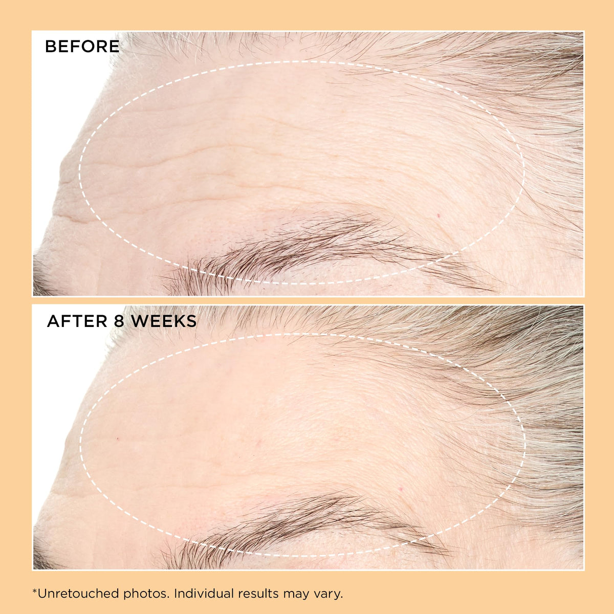 Perricone MD cream applied to skin demonstrating immediate smoothing benefit