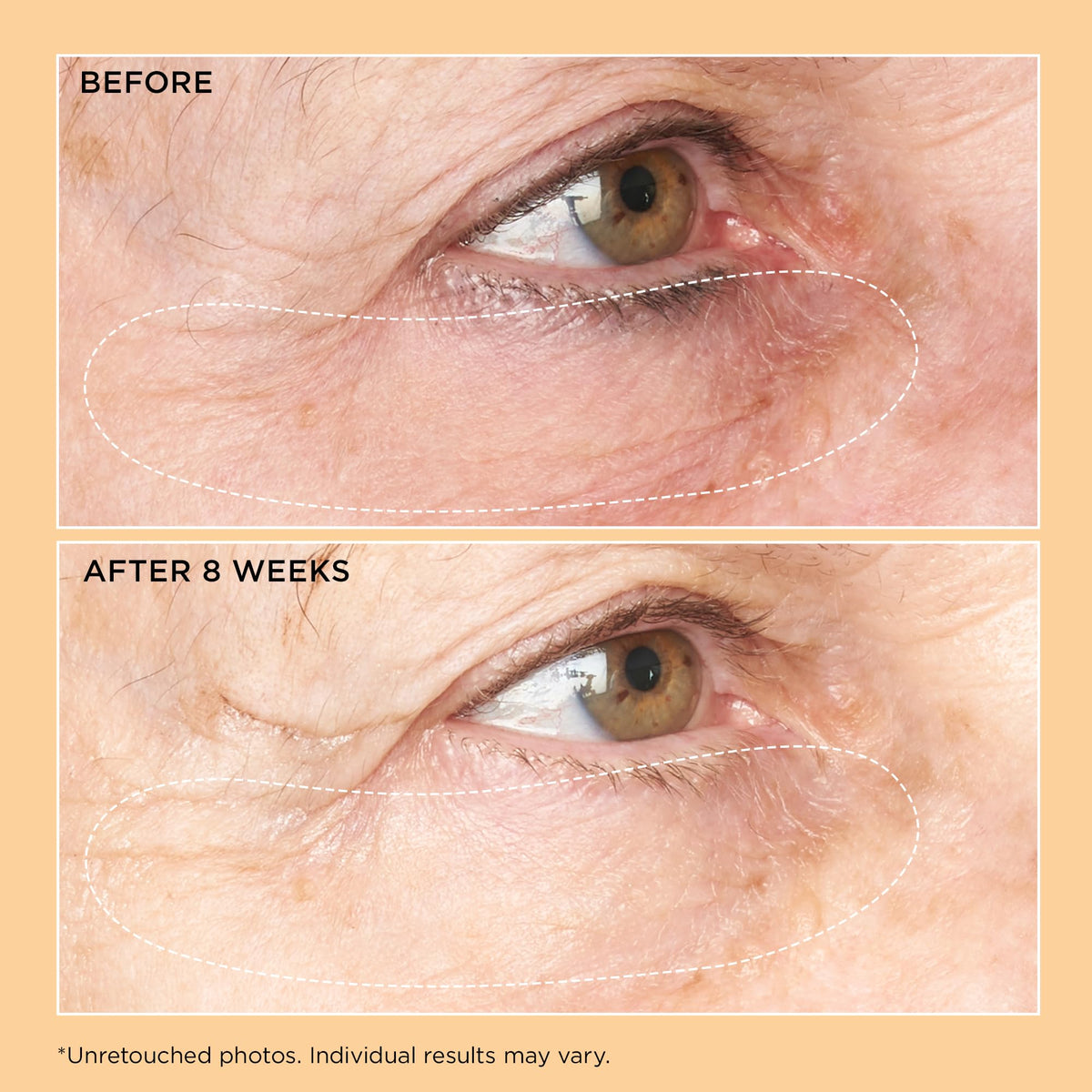 Perricone MD label close-up showing product name and ingredient clarity benefit