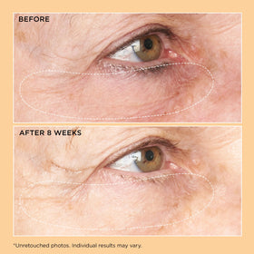 Perricone MD label close-up showing product name and ingredient clarity benefit