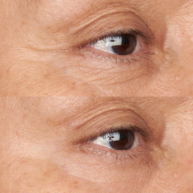 Perricone MD cream texture close-up highlighting rich hydrating squalane feel