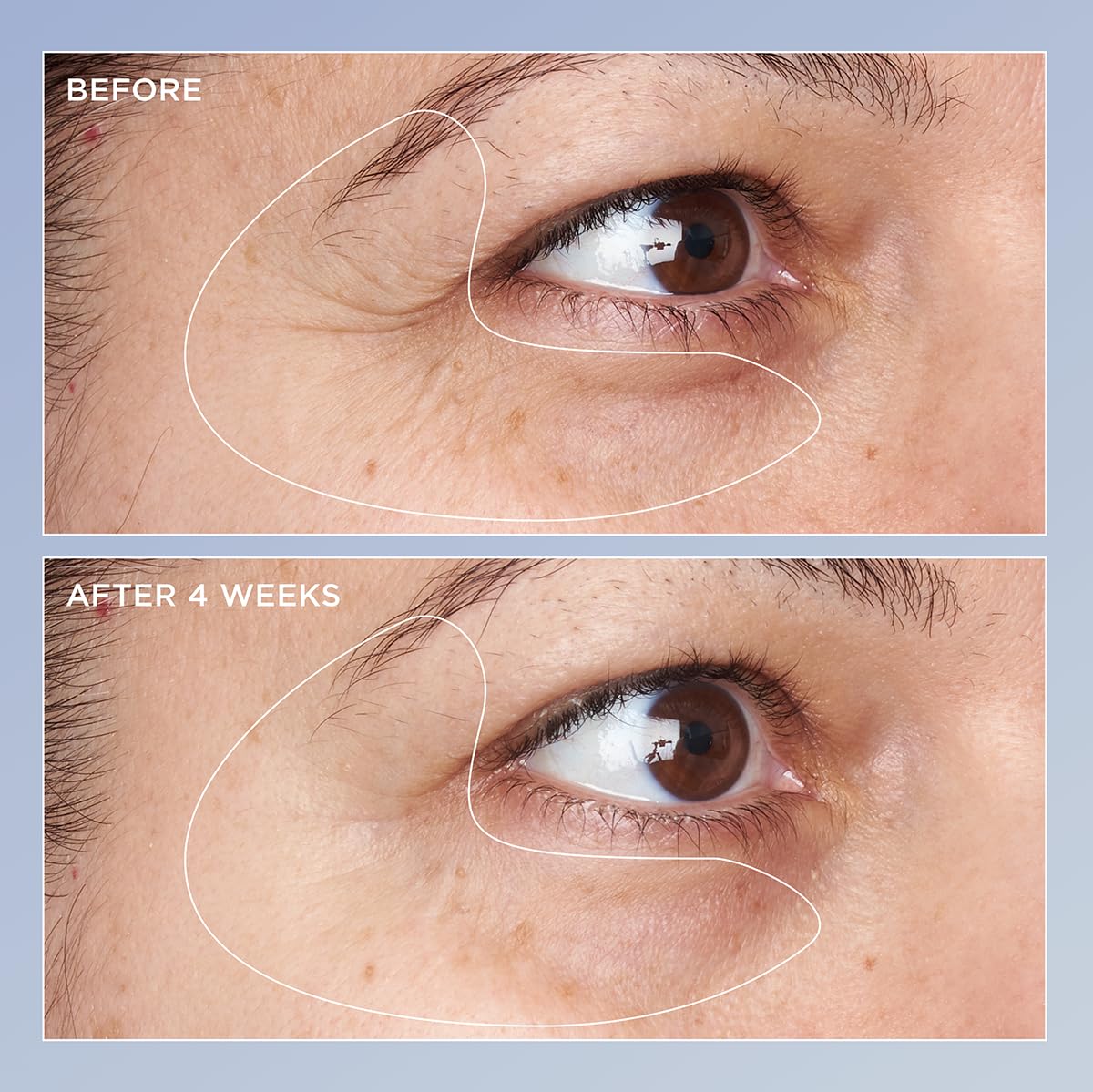 Perricone MD small amount on hand demonstrating serum spreadability and lightweight finish