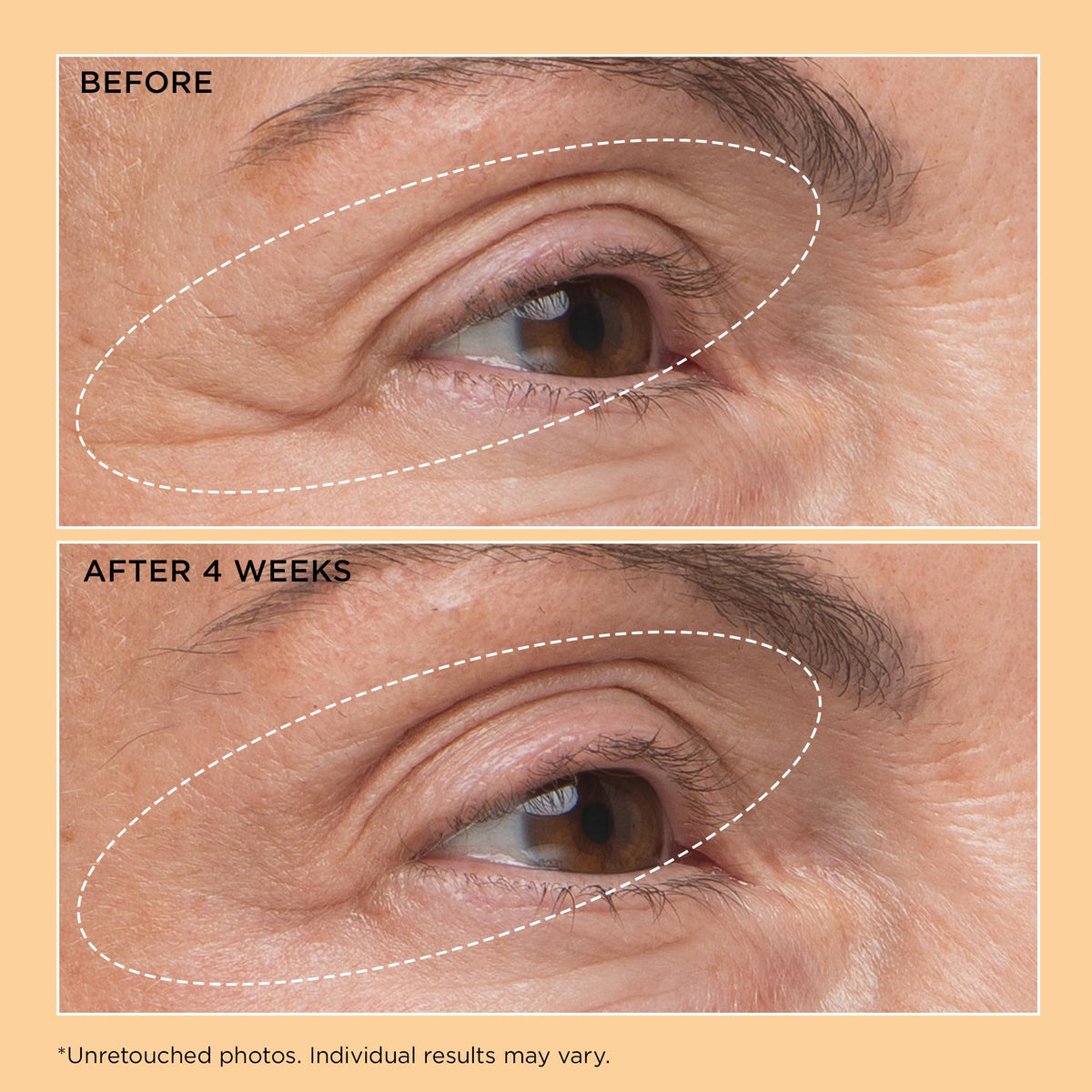 Perricone MD label close-up highlighting active ingredients and purpose