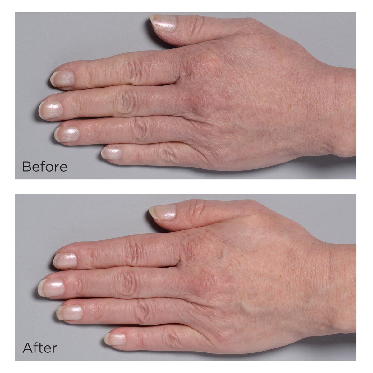 Perricone MD hand therapy being massaged into hands for smoother skin