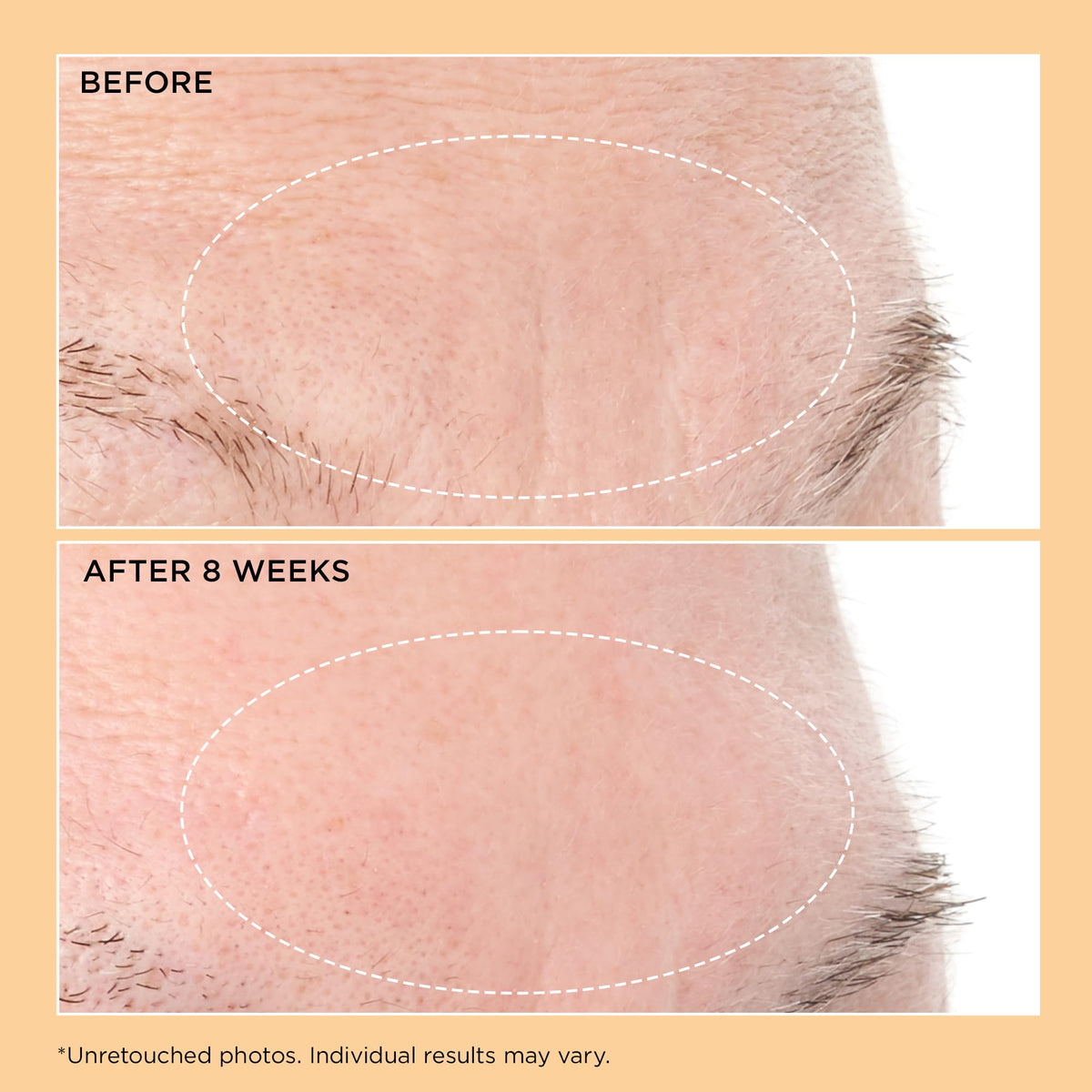 Perricone MD ingredients flatlay showing key actives that support smoother texture