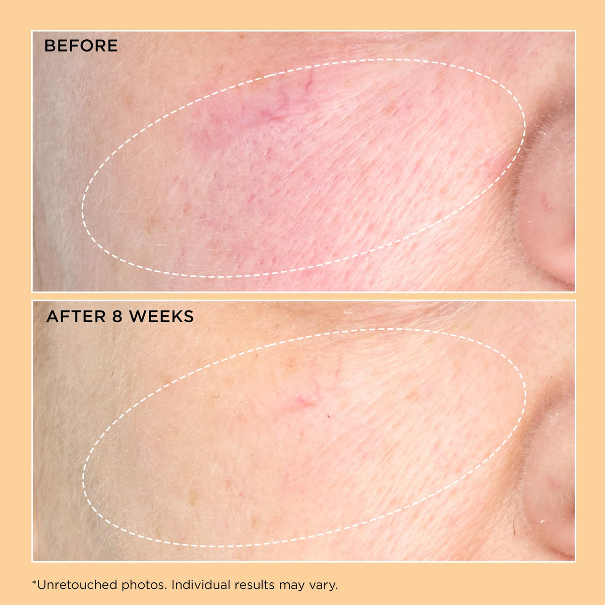 Perricone MD label close-up highlighting key ingredients for transparency