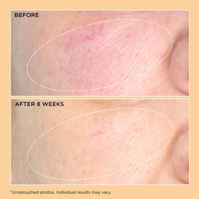 Perricone MD label close-up highlighting key ingredients for transparency