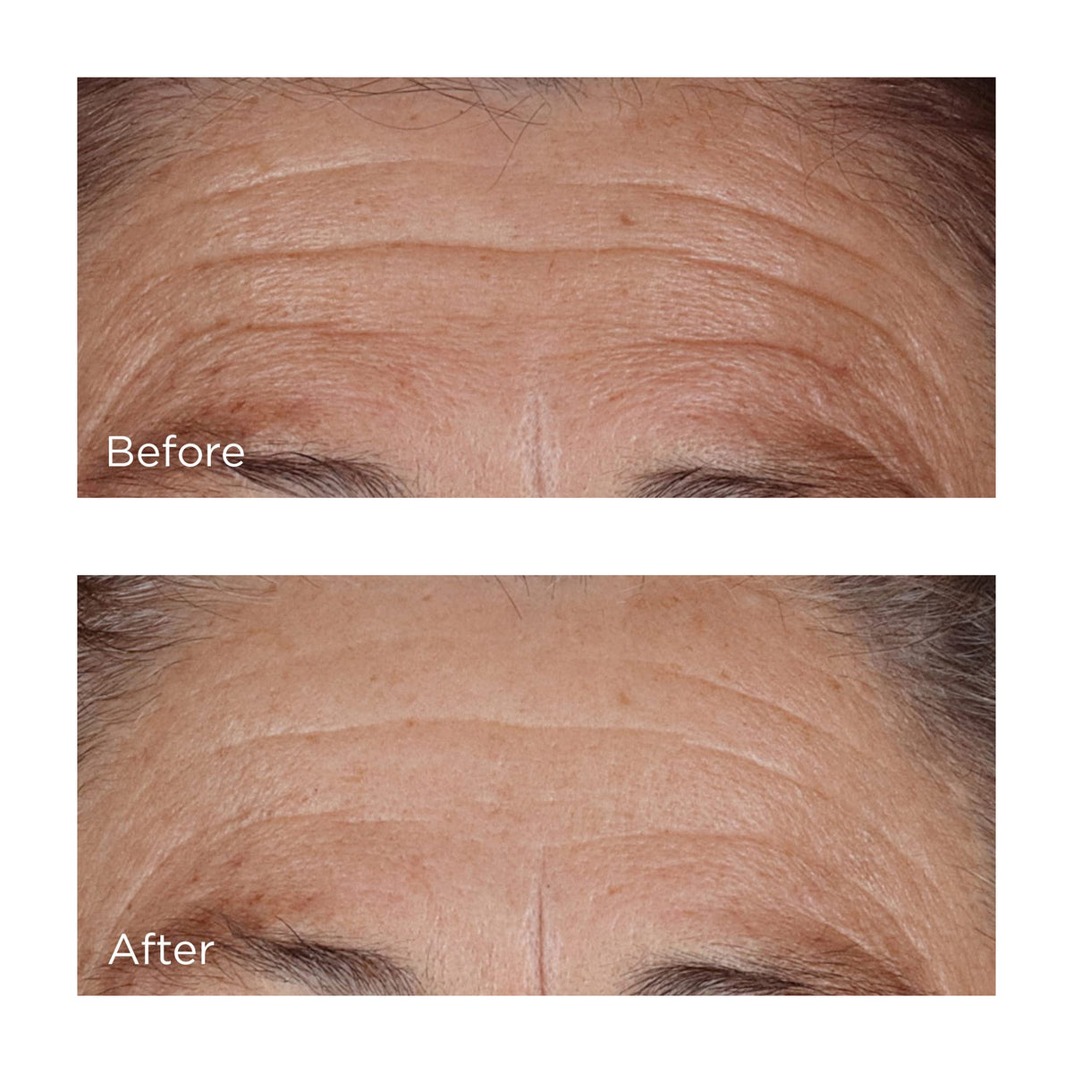 Perricone MD label close-up displaying hyaluronic complex, niacinamide benefits