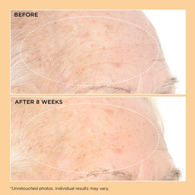 Perricone MD on bathroom counter lifestyle scene showing daily routine fit