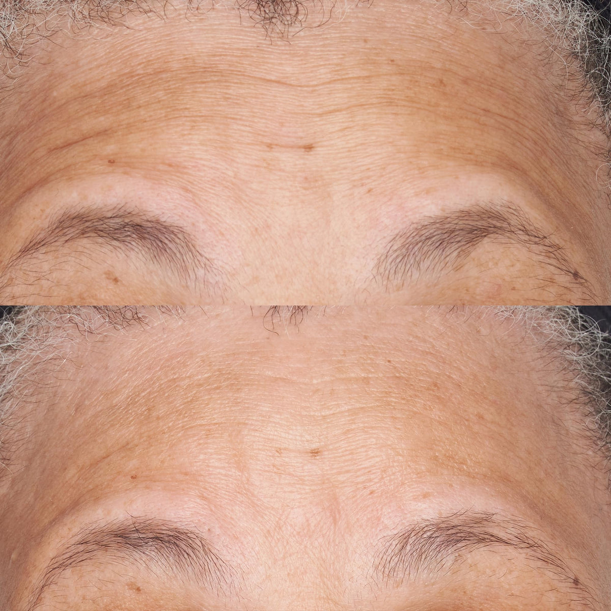Perricone MD moisturizer in routine, demonstrates soothing hydration for sensitive skin