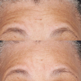 Perricone MD moisturizer in routine, demonstrates soothing hydration for sensitive skin