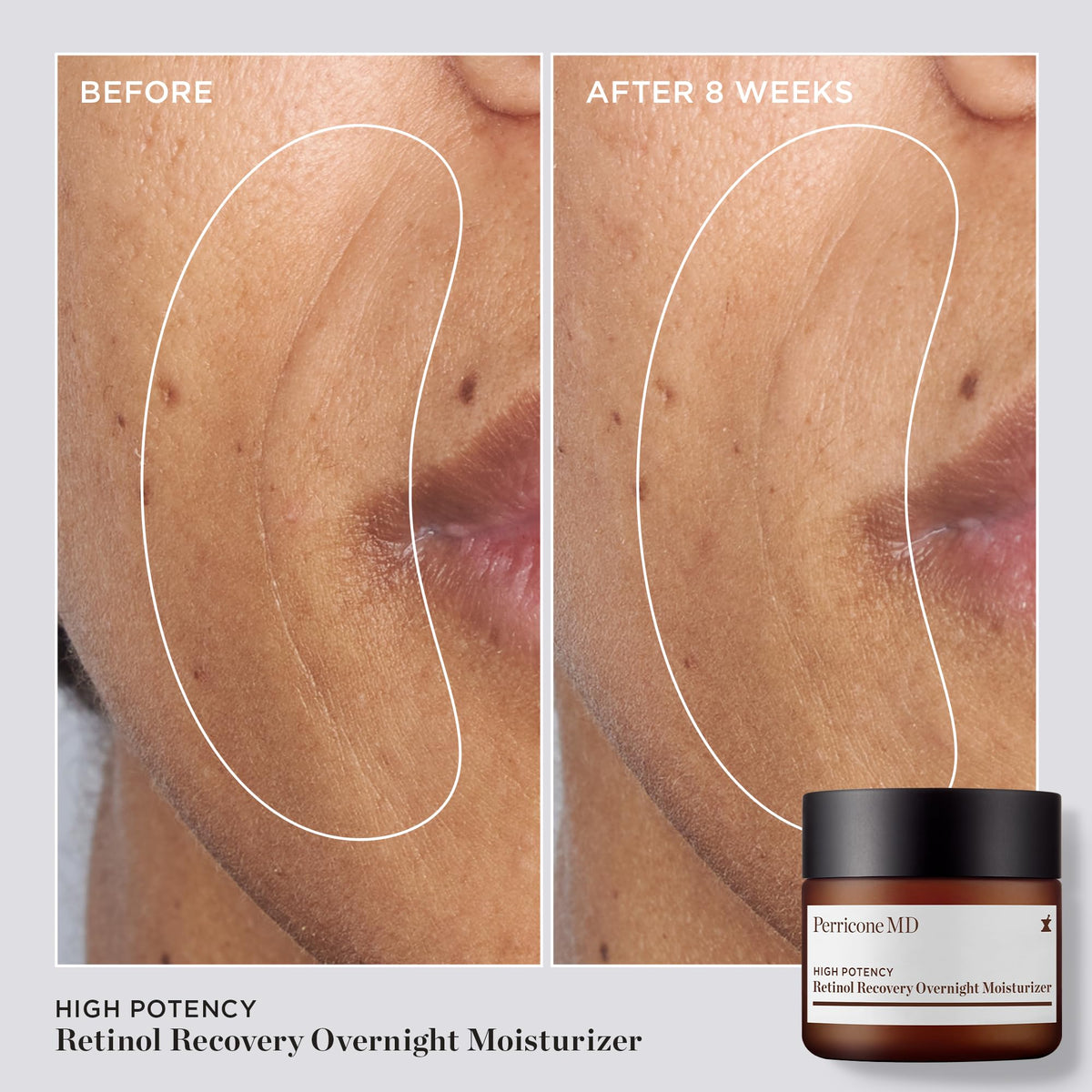 Perricone MD open jar top view showing cream and easy scoop for nightly application