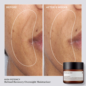 Perricone MD open jar top view showing cream and easy scoop for nightly application