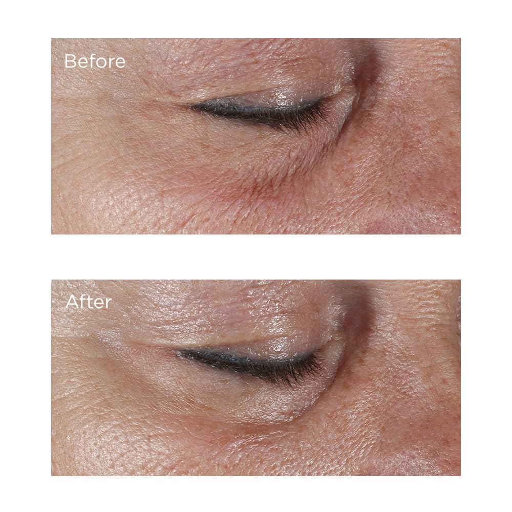 Perricone MD size comparison with hand, shows compact 0.5 fl oz travel-friendly convenience