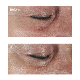 Perricone MD size comparison with hand, shows compact 0.5 fl oz travel-friendly convenience
