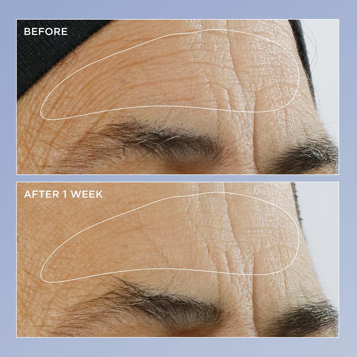 Perricone MD serum texture close-up highlighting lightweight, fast-absorbing finish