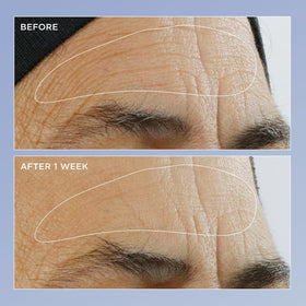 Perricone MD serum texture close-up highlighting lightweight, fast-absorbing finish