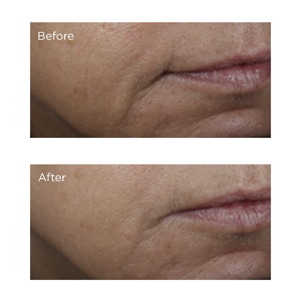Perricone MD ingredients label close-up showing Vitamin C Ester and glycolic acid