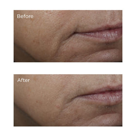 Perricone MD ingredients label close-up showing Vitamin C Ester and glycolic acid