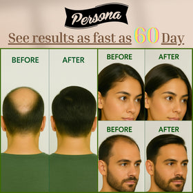 Persona Beauty bottle beside castor oil and botanical extracts highlighting ingredients
