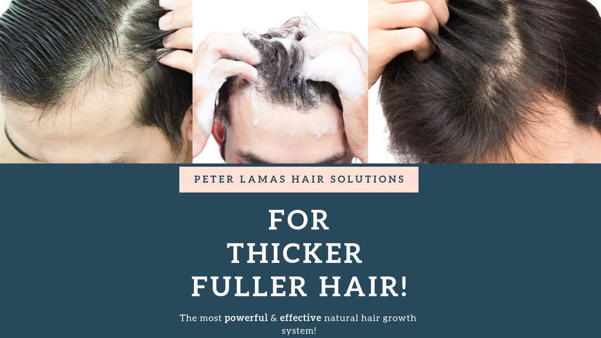 Peter Lamas before and after hair visual showing fuller-looking hair appearance
