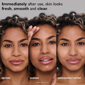 Peter Thomas Roth gel texture close-up revealing non-abrasive cellulose beads and glow