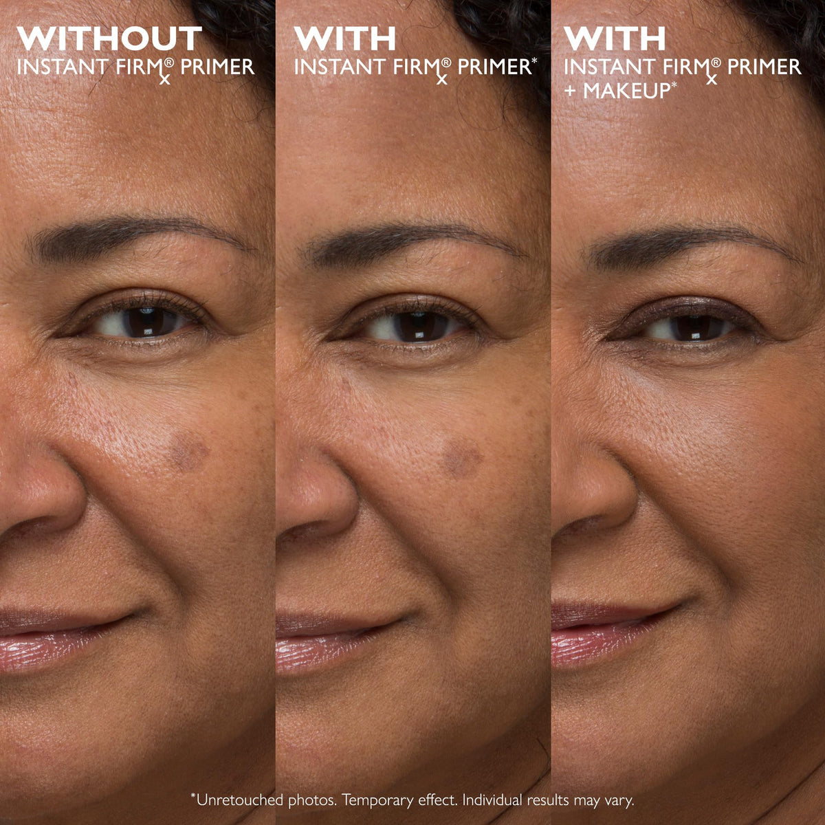 Peter Thomas Roth before and after swipe demonstrating tightened skin look