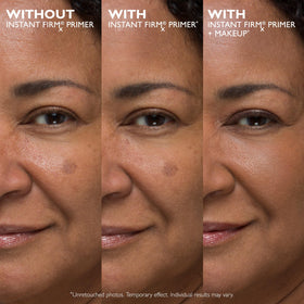 Peter Thomas Roth before and after swipe demonstrating tightened skin look