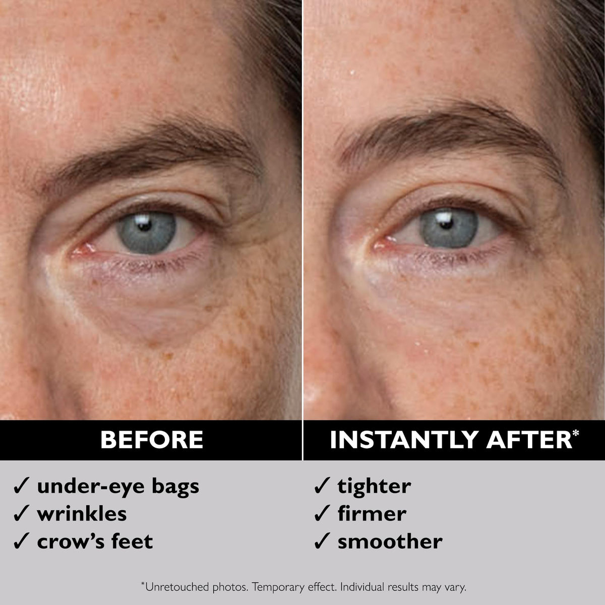 Peter Thomas Roth before and after under-eye split showing visible smoothing benefit