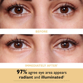 Peter Thomas Roth opened pouch with two gel patches ready to apply and glow