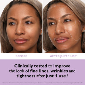 Peter Thomas Roth patches applied to forehead and cheeks demonstrating targeted lift benefit