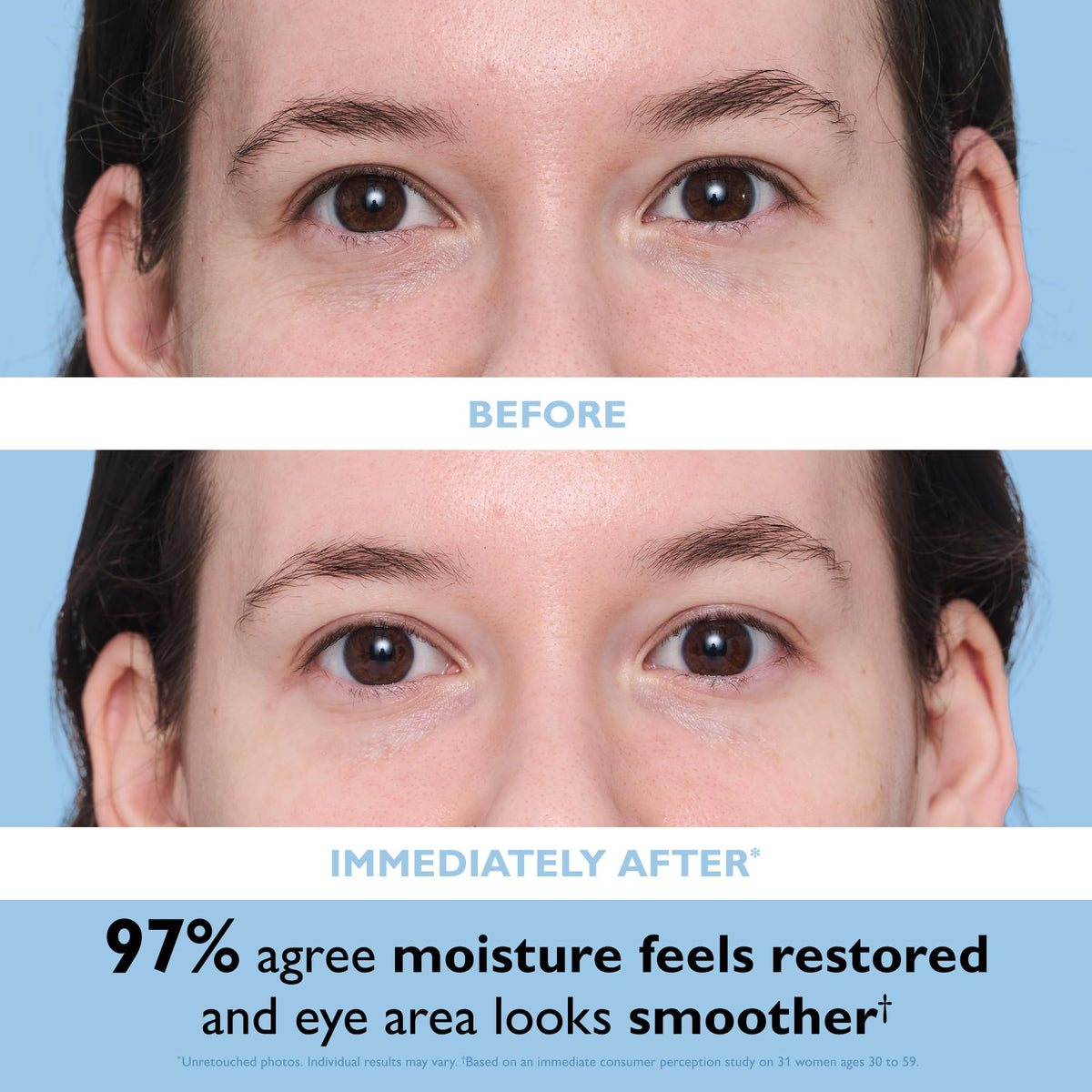 Peter Thomas Roth patches applied under eye reducing puffiness