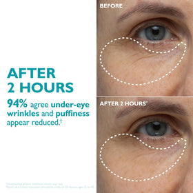 Peter Thomas Roth single tape showing adhesive back for secure wear