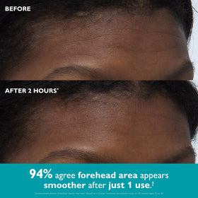 Peter Thomas Roth under-eye tape applied to reduce puffiness overnight