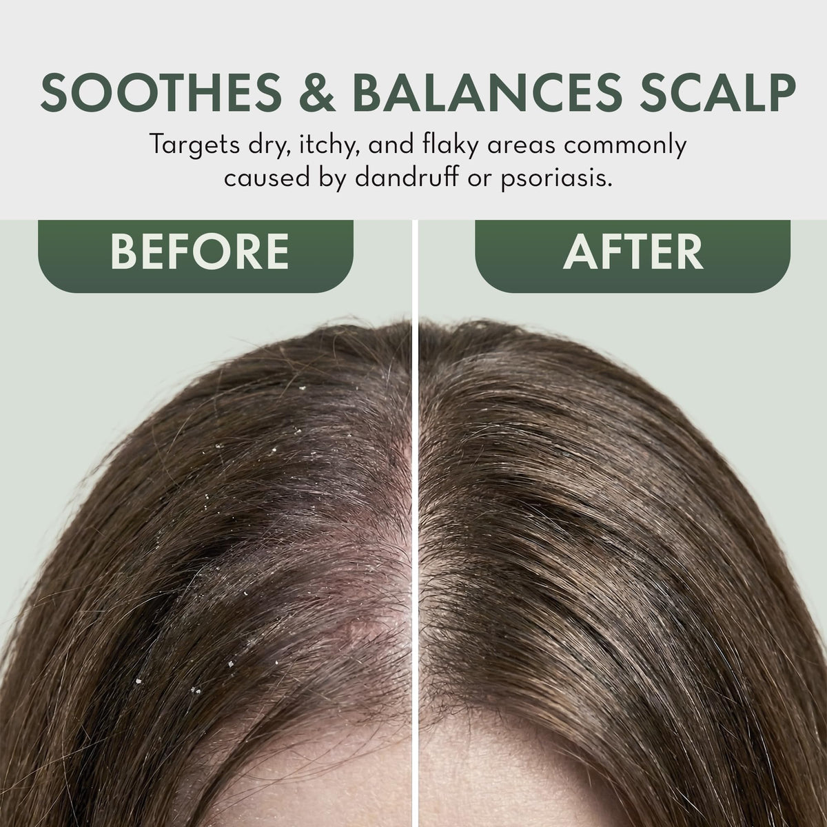 PHARM TO TABLE scalp being spritzed to soothe and hydrate