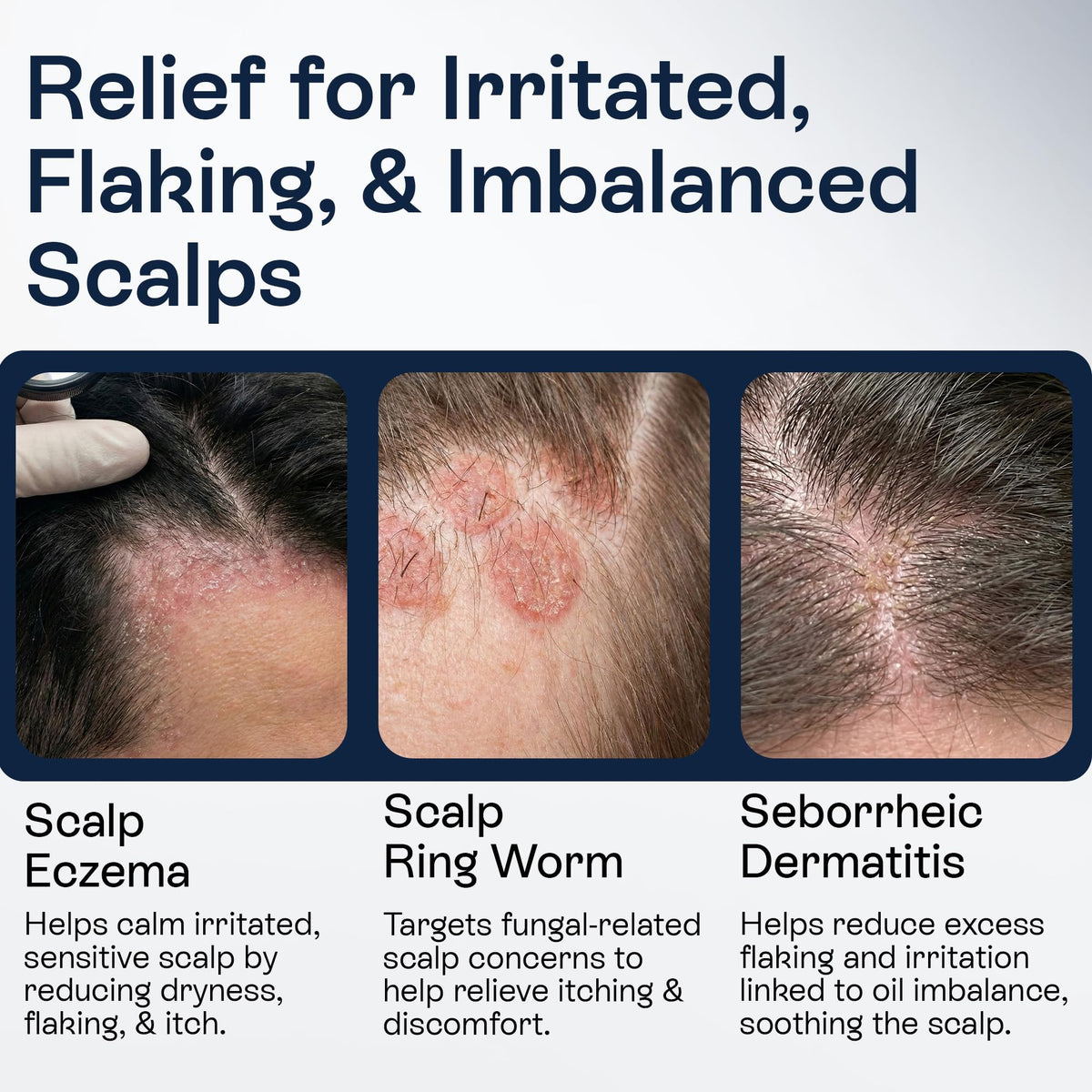 Pharmlitalia application at hairline showing targeted relief benefit