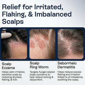 Pharmlitalia application at hairline showing targeted relief benefit