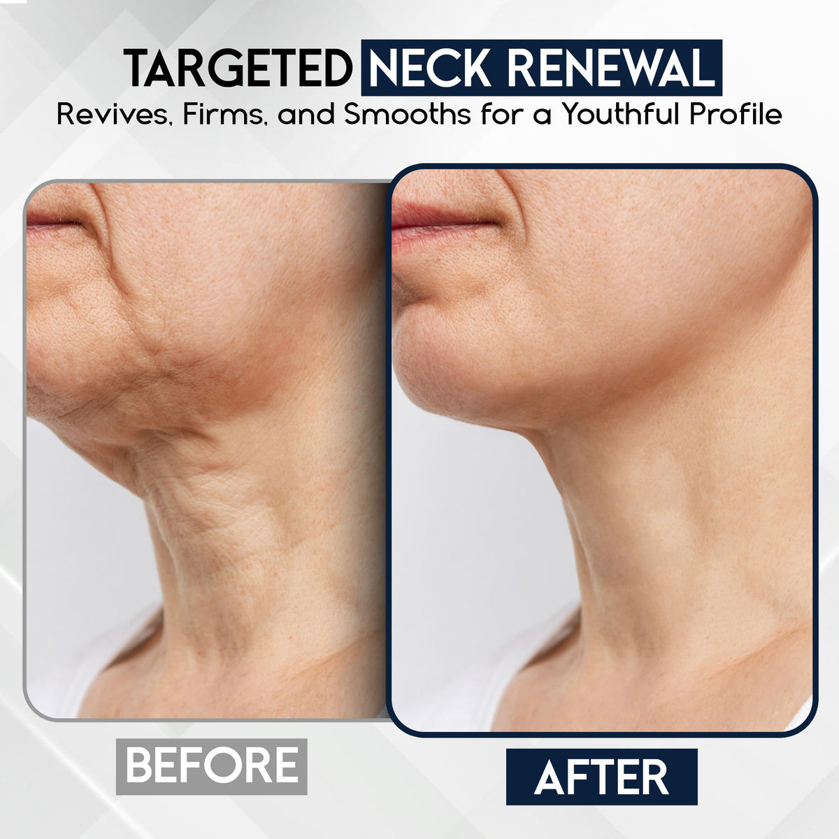 Pharmlitalia applied to neck illustrating lifting massage technique