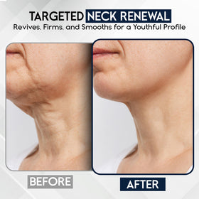 Pharmlitalia applied to neck illustrating lifting massage technique