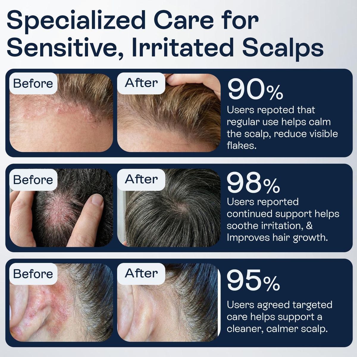 Pharmlitalia conceptual before-after flake reduction visualization benefit