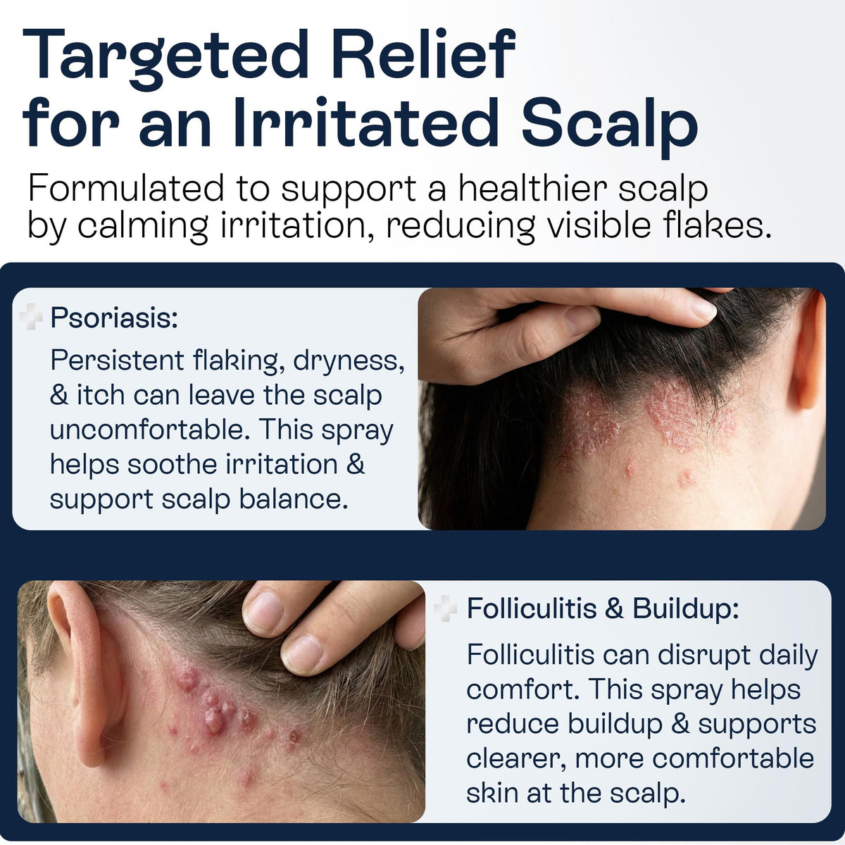 Pharmlitalia spray nozzle close-up for precise scalp application benefit