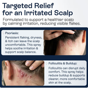 Pharmlitalia spray nozzle close-up for precise scalp application benefit