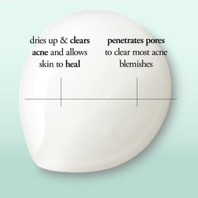 philosophy applying spot treatment to blemish demonstrating targeted drying and soothing