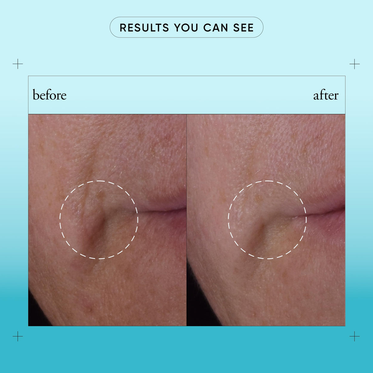 philosophy serum in bathroom routine demonstrating daily use with moisturizer