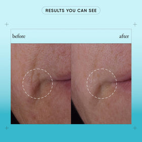 philosophy serum in bathroom routine demonstrating daily use with moisturizer
