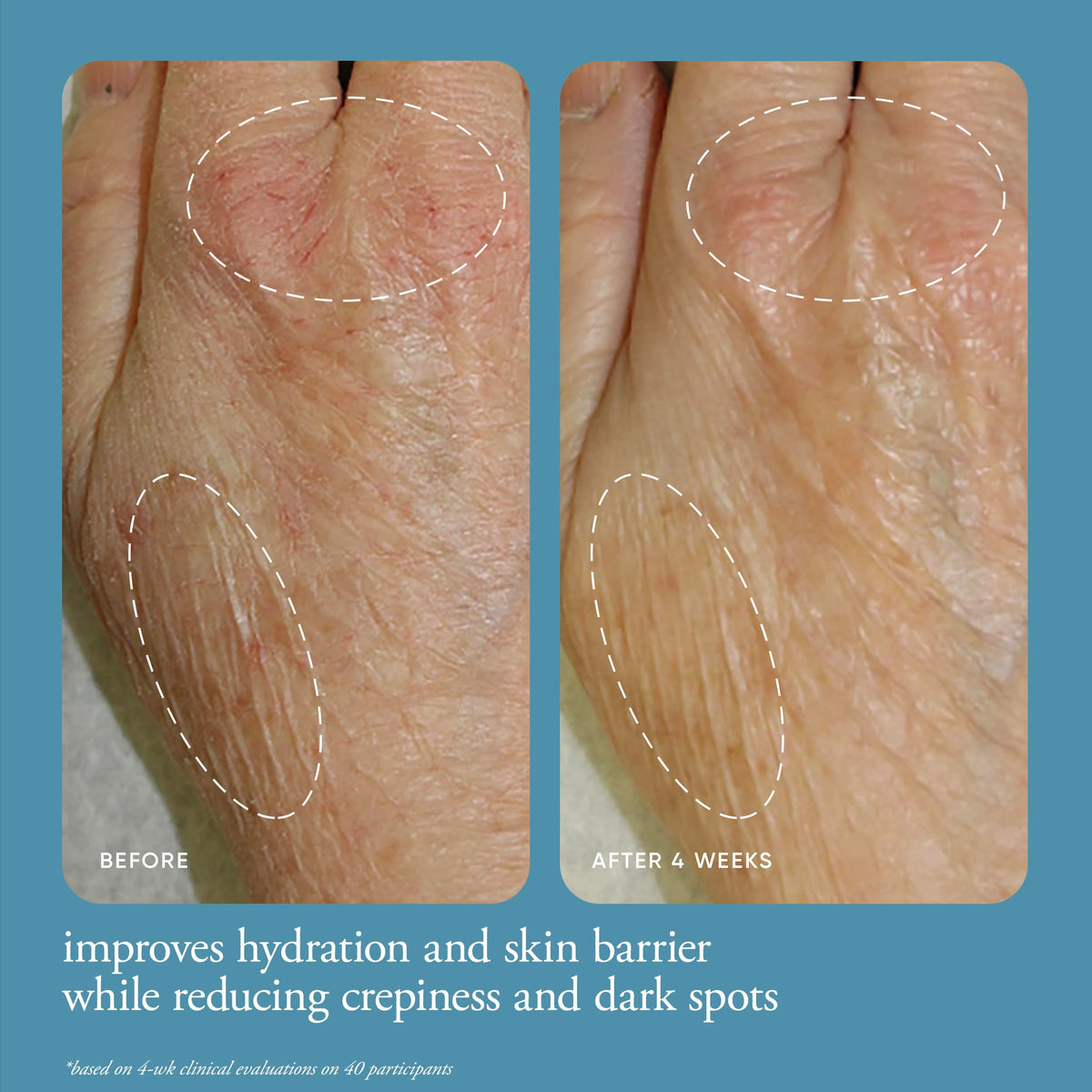 philosophy cream applied to hands demonstrating rapid absorption and non-greasy feel
