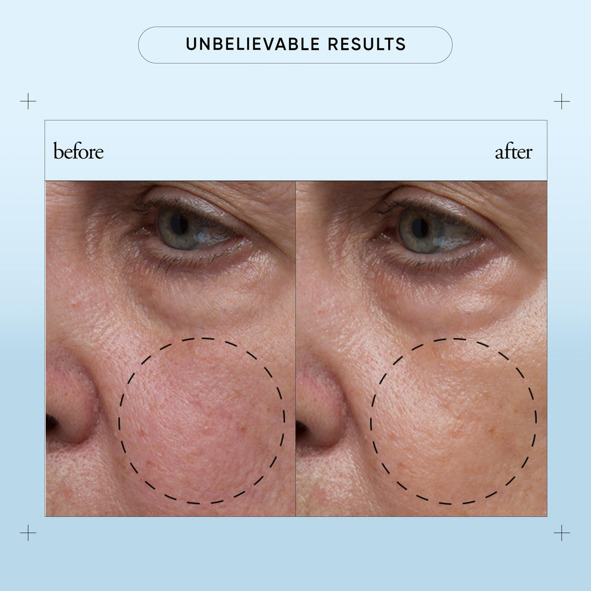 philosophy drop of serum on hand demonstrating fast-absorbing hydration