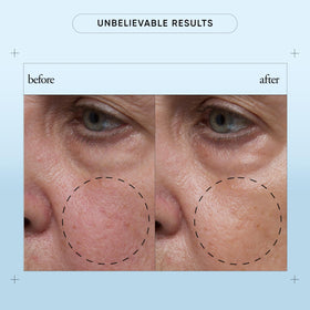 philosophy drop of serum on hand demonstrating fast-absorbing hydration