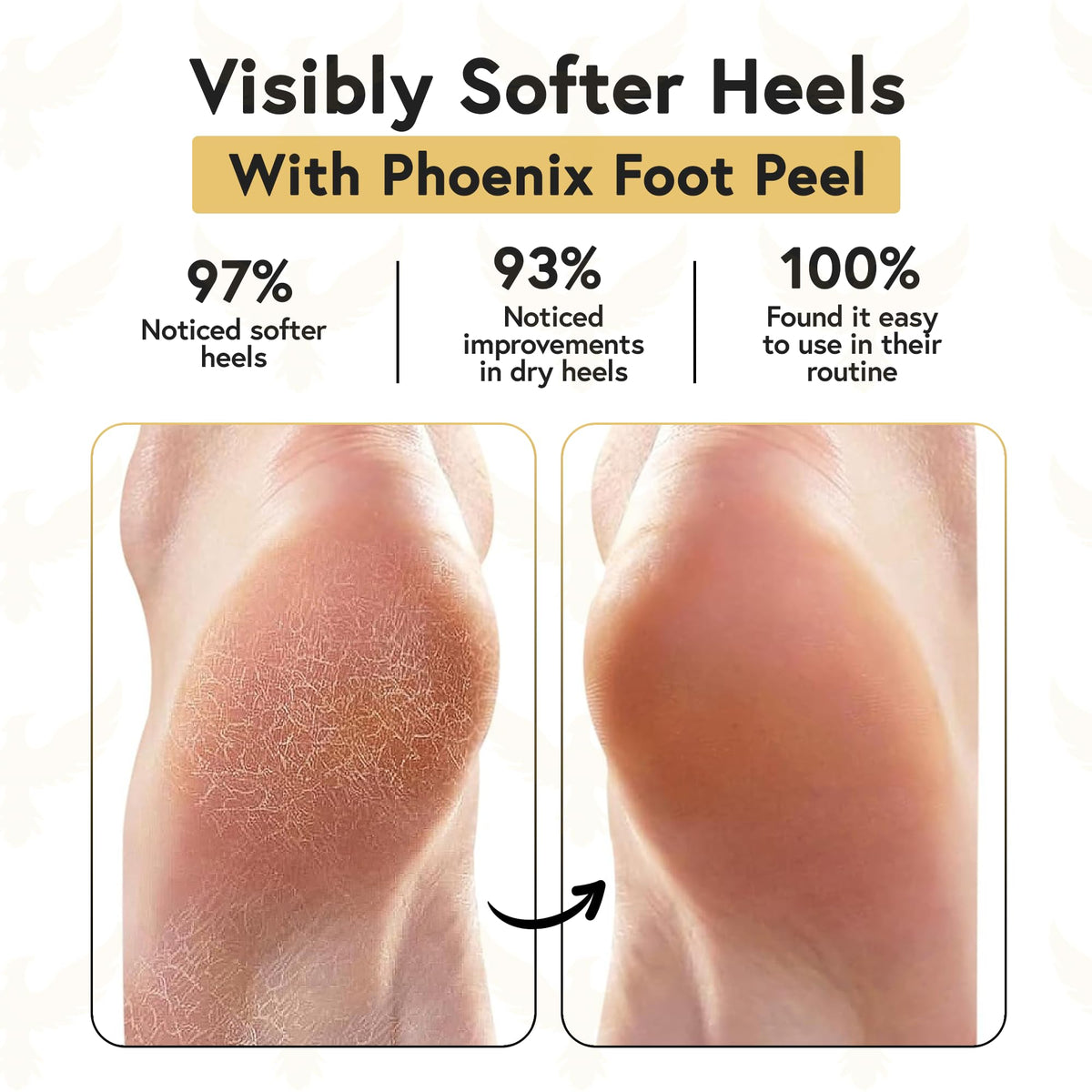 Phoenix Foot Peel silicone lining close-up locking in moisturizers